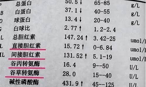 高考体检转氨酶136过吗能过吗_高考体检转氨酶136过吗